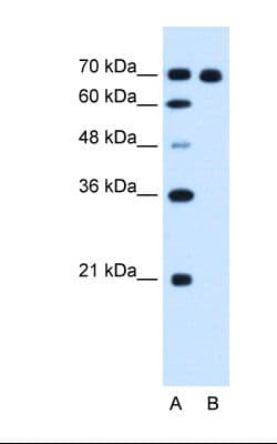 R1 / RRM1 Antibody (aa723-772)