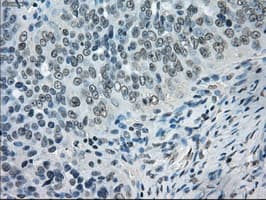 CRYAB / Alpha B Crystallin Antibody (clone OTI3C2)