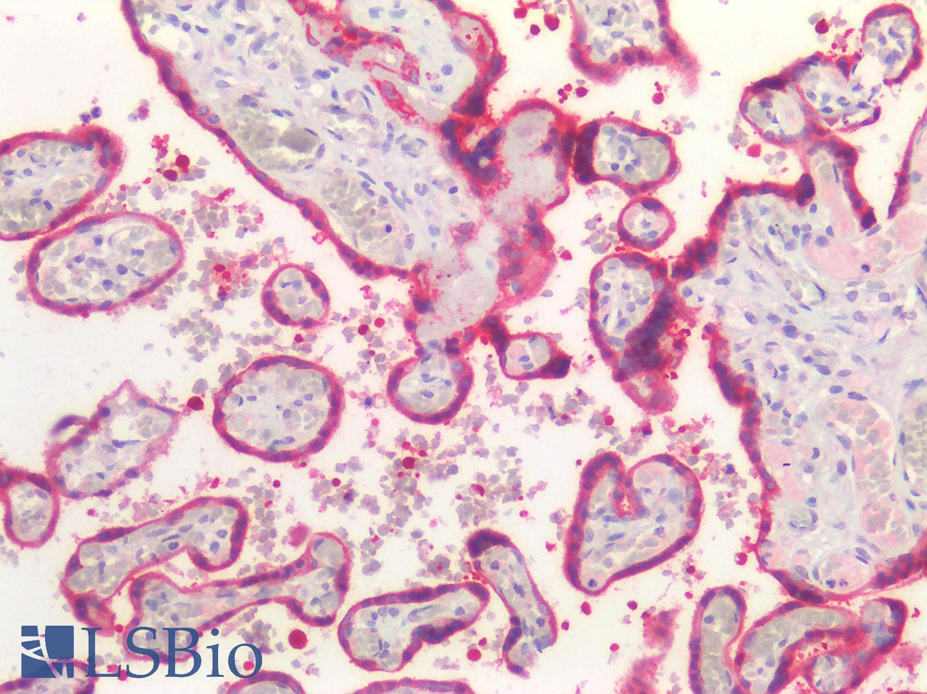 PathPlus™ Polyclonal Rabbit anti-Human UCHL1 / PGP9.5 Antibody (IHC)