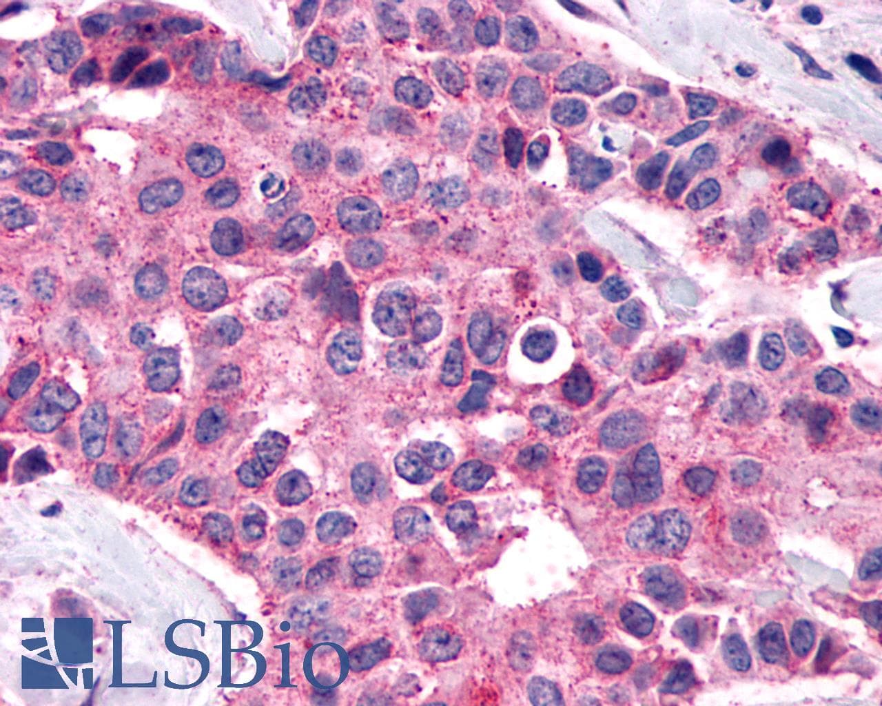PathPlus™ Polyclonal Rabbit anti-Human F2RL1 / PAR2 Antibody (C-Terminus, IHC)