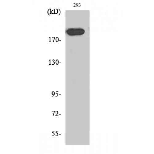 Polyclonal Rabbit anti-Human MRC2 / Endo180 Antibody (90-170 aa, N-terminal, IHC, IF, WB)