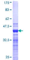 Human JMJD1C Protein (Recombinant GST, N-terminus)
