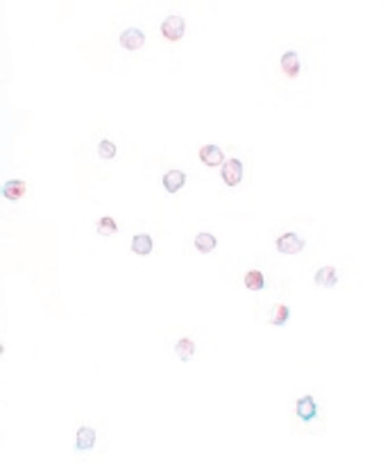 IHC-plus™ Polyclonal Rabbit anti-Human CD225 / IFITM1 Antibody (IHC, IF, WB)