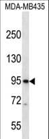 CNGB3 / CNG Channel Beta-3 Antibody (aa26-55)