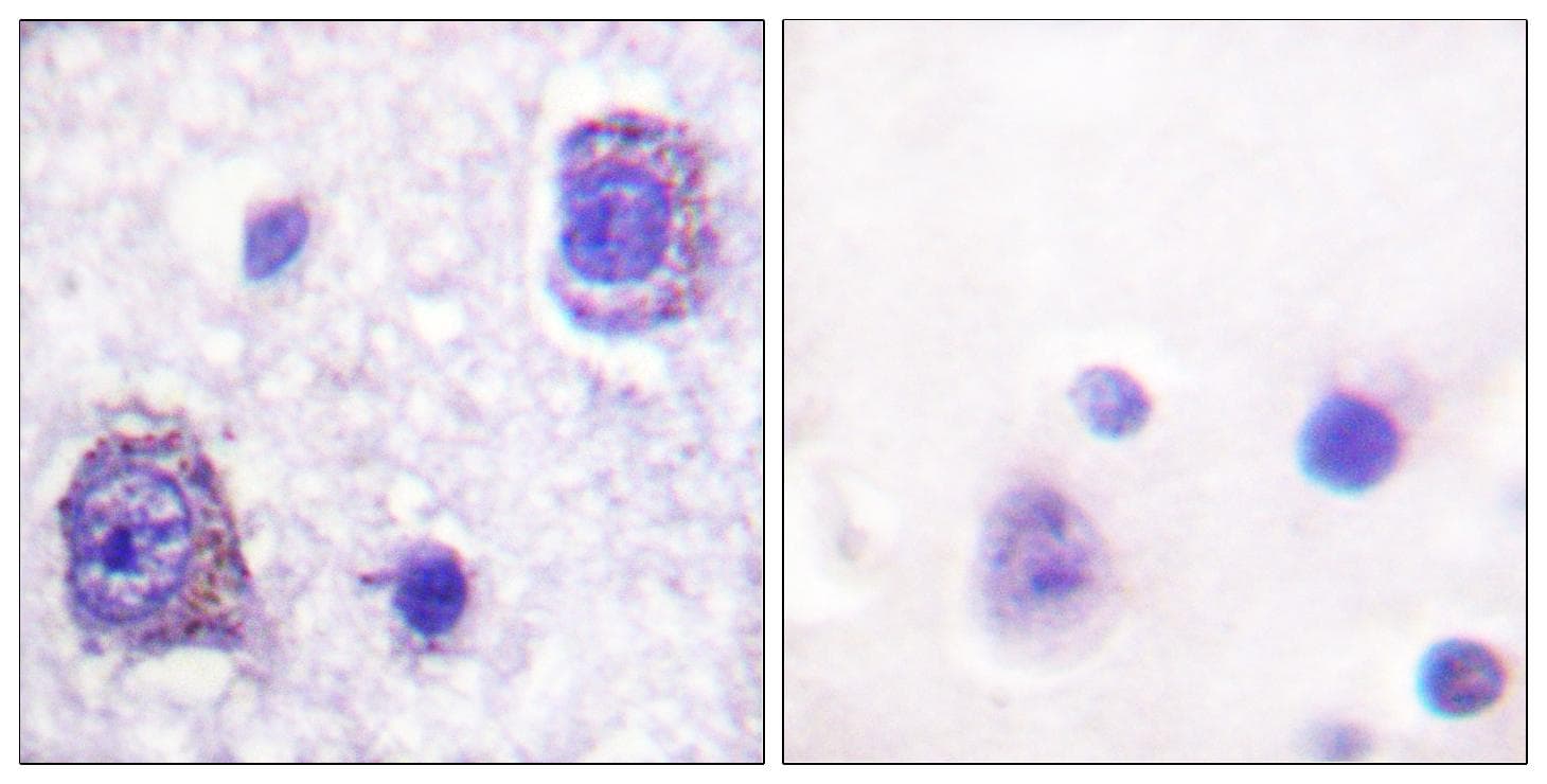 RPS6KB1 / P70S6K / S6K Antibody (p229)