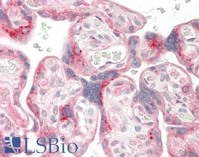 IHC-plus™ TSAP6 / STEAP3 Antibody