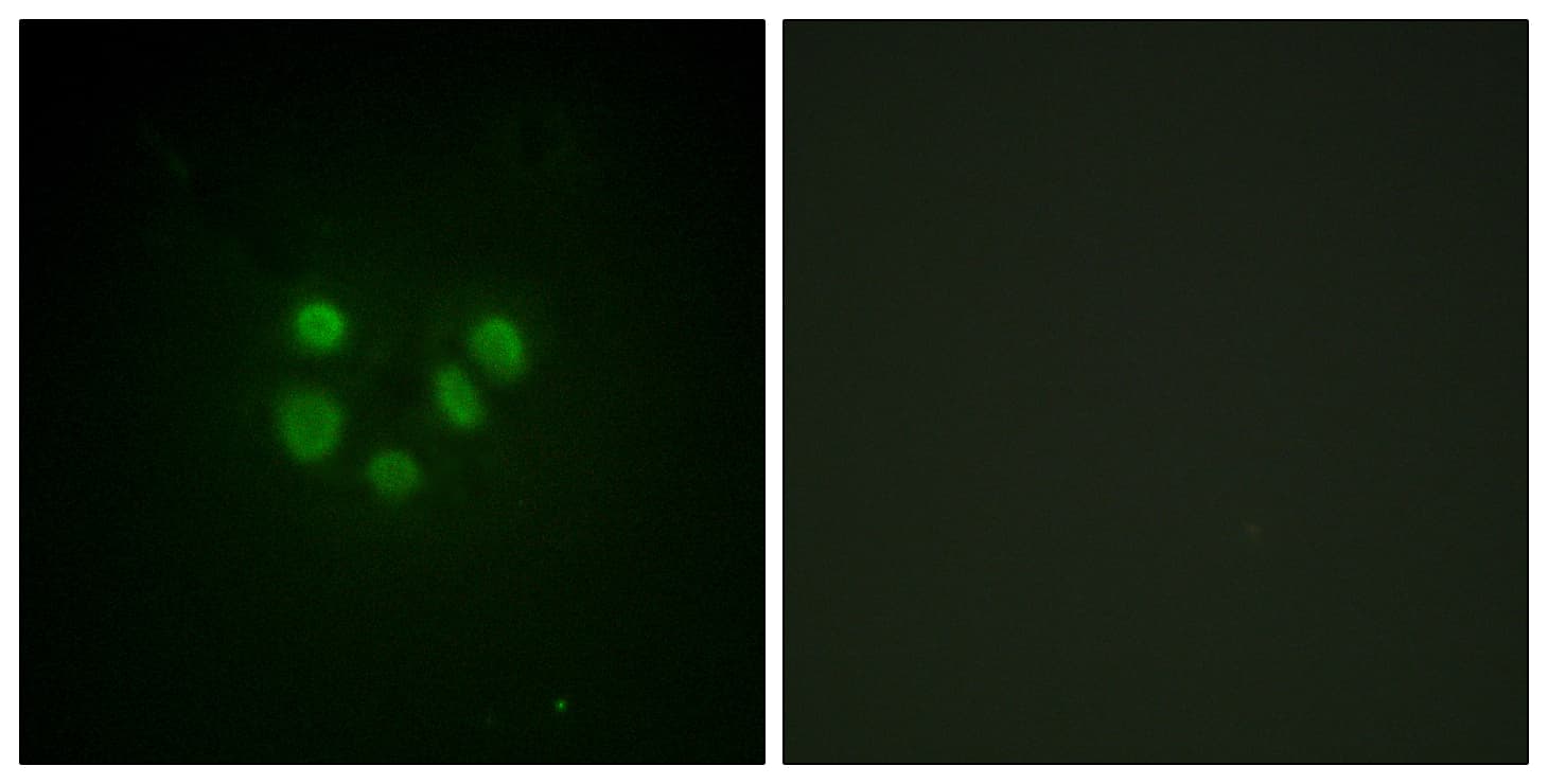 Polyclonal Rabbit anti-Human BLM Antibody (aa65-114, IHC, IF)