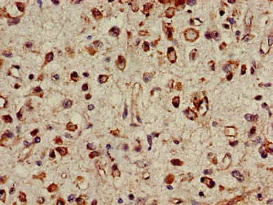 PSMC4 Antibody