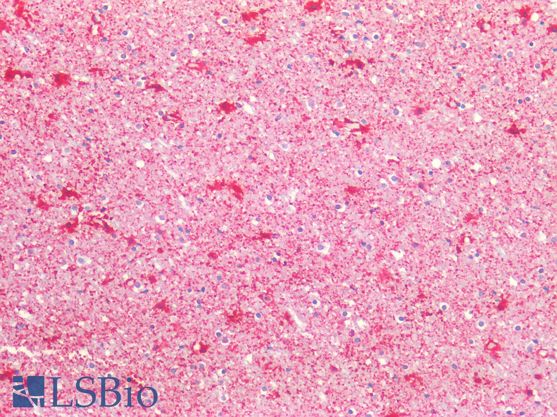 PathPlus™ Polyclonal Rabbit anti-Human ENO1 / Alpha Enolase Antibody (IHC, WB)