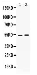 SERPINA1 / Alpha 1 Antitrypsin Antibody