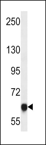 Polyclonal Rabbit anti-Human MAGED4 Antibody (aa328-357, IHC, WB)