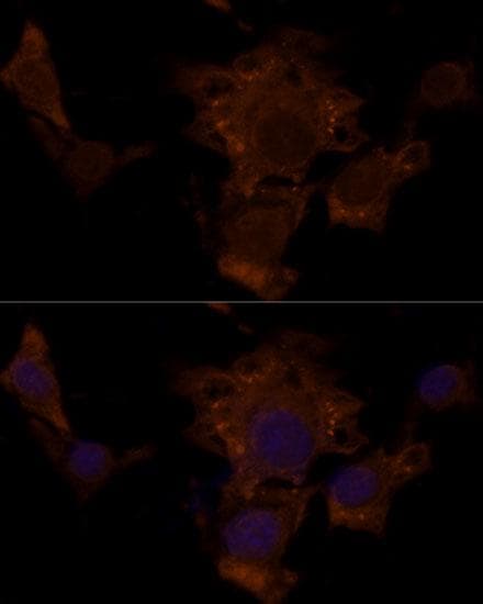 Tuberin / TSC2 Antibody