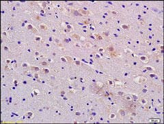 ADM / Adrenomedullin Antibody