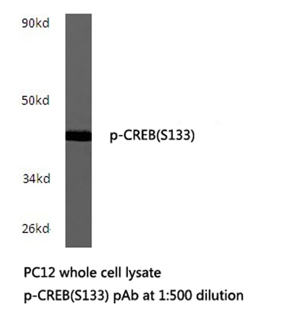CREB1 / CREB Antibody (phospho-Ser133)