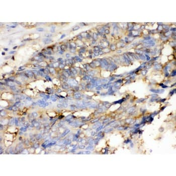 CFL1 / Cofilin Antibody (aa122-152)