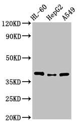 Polyclonal Rabbit anti-Human MCU / CCDC109A Antibody (IHC, WB)