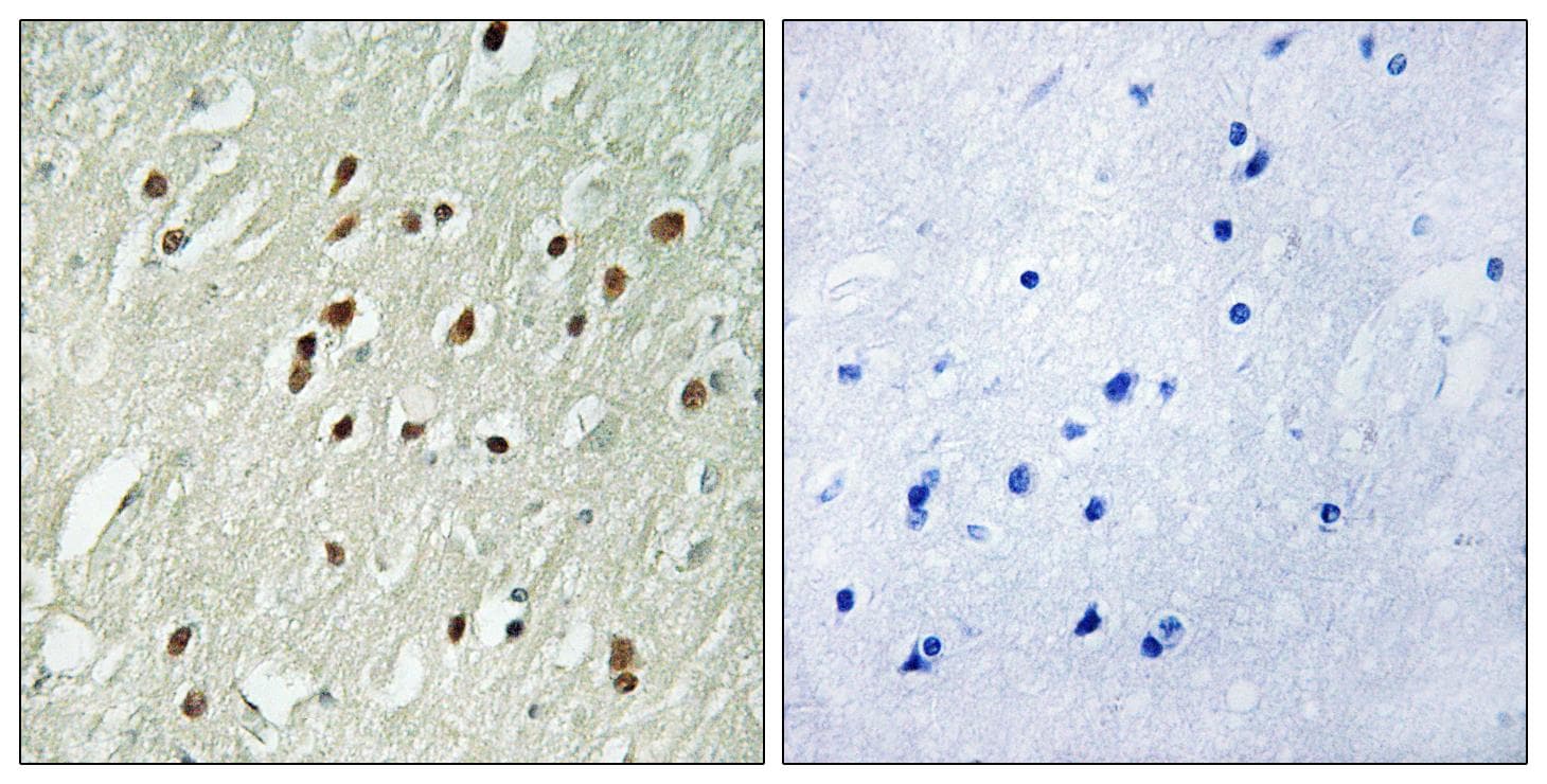 Polyclonal Rabbit anti-Human CNTROB Antibody (IHC)