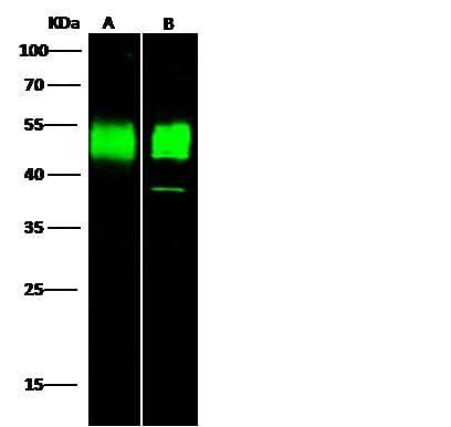 CD2 Antibody (Preservative Free)