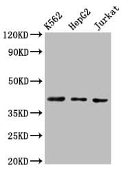 Polyclonal Rabbit anti-Human CXCR3 Antibody (IHC, IF, WB)
