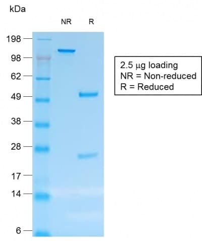 IHC-plus™ CD30 Antibody (clone rCD30/412)
