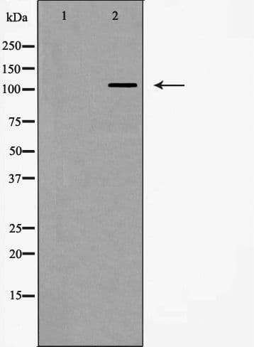 ITGA5/Integrin Alpha 5/CD49e Antibody