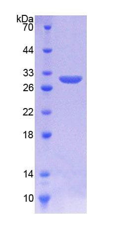 Human KREMEN1 / KREMEN-1 Protein (Recombinant His, N-Terminal)