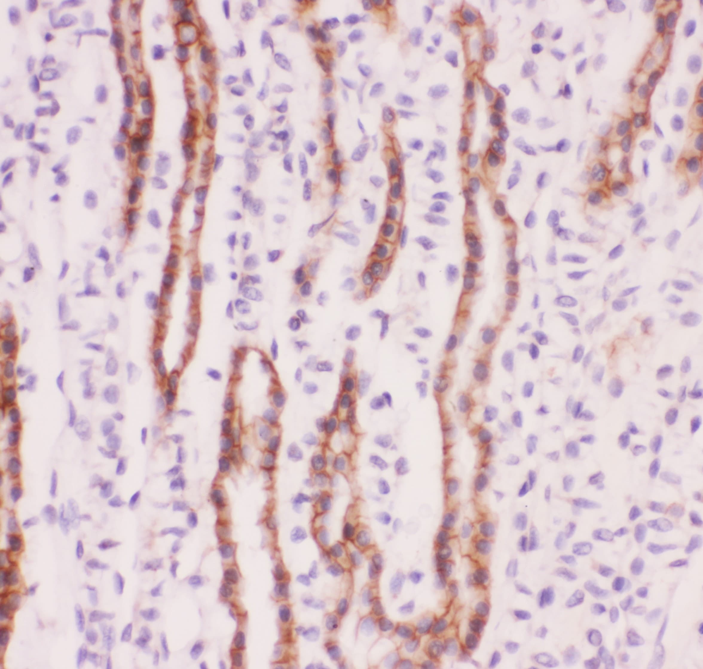 SLC9A1 / NHE1 Antibody (aa543-815)