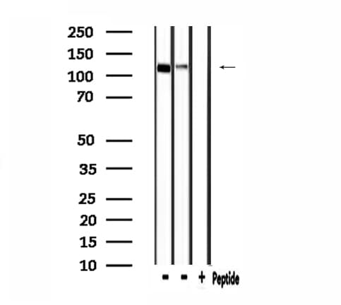 IARS2 Antibody