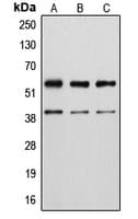Vimentin Antibody (phospho-Ser56)