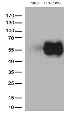 Monoclonal Mouse anti-Human PDCD1 / CD279 / PD-1 Antibody (clone OTI2D10, IHC, WB)