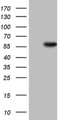 Monoclonal Mouse anti-Human HNF4A / HNF4 Antibody (clone OTI2H2, aa1-315, IHC, WB)