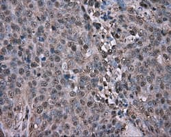 GPI Antibody (clone OTI7G10, Carrier-free)