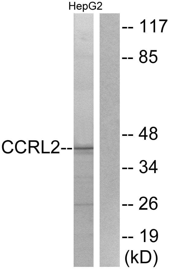 Polyclonal Rabbit anti-Human CCRL2 Antibody (IF, WB)