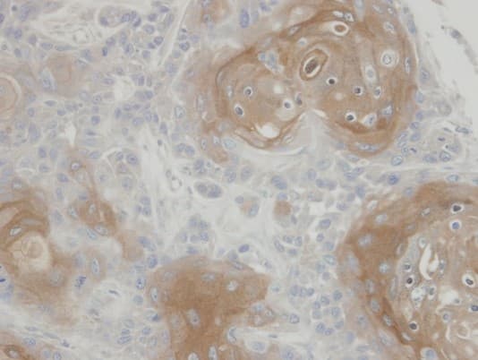 Polyclonal Rabbit anti-Human CLIC3 Antibody (aa1-236, IHC, WB)
