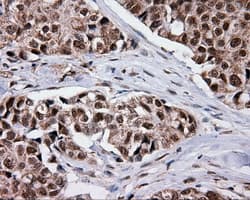 SRR / Serine Racemase Antibody (clone OTI7E8, Carrier-free)
