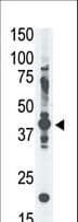 MAGEA4 Antibody (aa9-38)