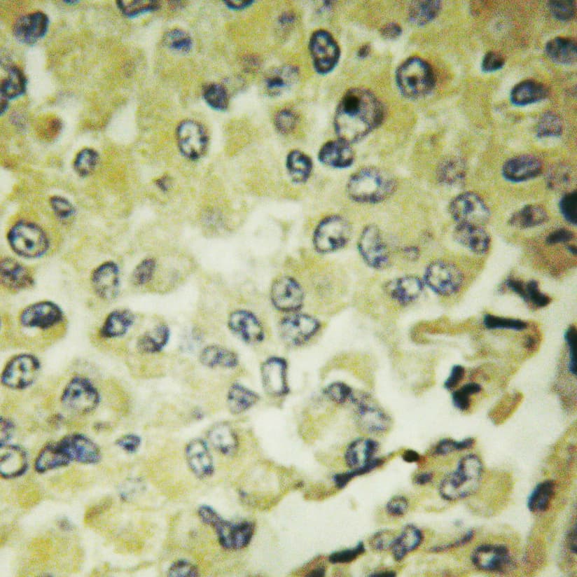 Polyclonal Rabbit anti-Human NFKBIE / IKB Epsilon Antibody (IHC, IF, WB)