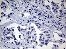 NBN / Nibrin Antibody (aa183-460, clone OTI5E11, Carrier-free)