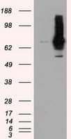 Monoclonal Mouse anti-Human RIP1 / RALBP1 Antibody (clone OTI11B2, IHC, IF, WB)