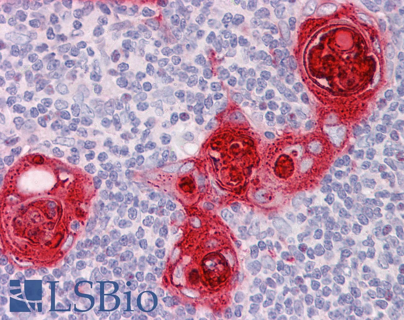 IHC-plus™ Polyclonal Goat anti-Human CXCR6 Antibody (aa321-333, IHC, WB)