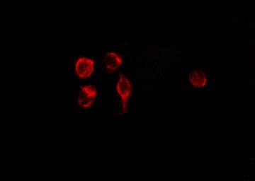 Polyclonal Rabbit anti-Human GDF15 Antibody (IF, WB)