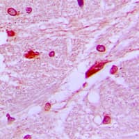 CUX1 / CASP Antibody (N-Terminus)