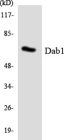 DAB1 Antibody (aa177-226)