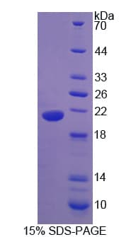 Rat UCN3 / SPC Protein (Recombinant His)