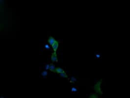 MAPK13 / p38delta Antibody (clone OTI1H3)