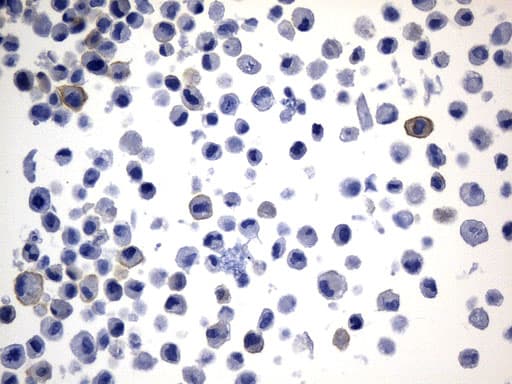 CD274 / B7-H1 / PD-L1 Antibody (aa19-290, clone UMAB229)