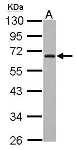 ZNF215 Antibody
