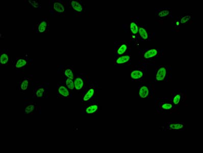 HIST1H2BB Antibody