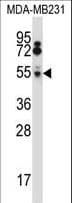 HTRA2 / OMI Antibody (aa73-102)