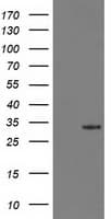 Monoclonal Mouse anti-Human 15-PGDH / HPGD Antibody (clone OTI2F5, IHC, WB)